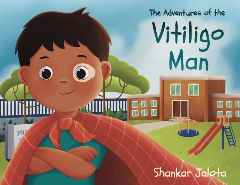 The Adventures of The Vitiligo Man By Shankar Jalota